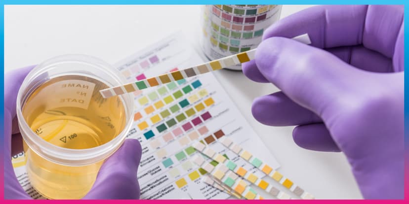 Blood Sugar (F) with Urine Sugar